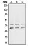 Heterogeneous Nuclear Ribonucleoprotein A1 antibody, LS-B14236, Lifespan Biosciences, Western Blot image 