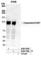 Cast antibody, A304-792A, Bethyl Labs, Immunoprecipitation image 