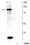 ATR Interacting Protein antibody, P03862, Boster Biological Technology, Western Blot image 