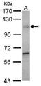 Probable ATP-dependent RNA helicase DDX20 antibody, GTX110962, GeneTex, Western Blot image 