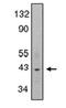 C-X-C Motif Chemokine Receptor 6 antibody, SP6322PX, Origene, Western Blot image 