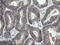 Cyclin Dependent Kinase Inhibitor 2B antibody, M01500, Boster Biological Technology, Immunohistochemistry paraffin image 
