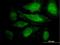 Cdk5 And Abl Enzyme Substrate 1 antibody, H00091768-B01P, Novus Biologicals, Immunocytochemistry image 