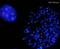 Centromere Protein E antibody, ab5093, Abcam, Immunocytochemistry image 