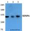 SUMO Specific Peptidase 6 antibody, A05088-1, Boster Biological Technology, Western Blot image 