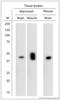 5-Hydroxytryptamine Receptor 4 antibody, LS-C829267, Lifespan Biosciences, Western Blot image 