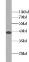 Zinc Finger CCCH-Type Containing, Antiviral 1 Like antibody, FNab09607, FineTest, Western Blot image 