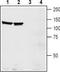 EPH Receptor A1 antibody, TA328634, Origene, Western Blot image 