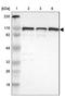 Cutaneous T-cell lymphoma-associated antigen 5 antibody, NBP1-85390, Novus Biologicals, Western Blot image 