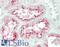 Decapping MRNA 1A antibody, LS-B14181, Lifespan Biosciences, Immunohistochemistry paraffin image 
