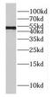 DnaJ Heat Shock Protein Family (Hsp40) Member A4 antibody, FNab02441, FineTest, Western Blot image 