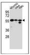 Forkhead Box N2 antibody, AP51717PU-N, Origene, Western Blot image 