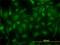 Creatine Kinase B antibody, H00001152-M01, Novus Biologicals, Immunofluorescence image 