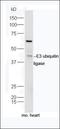 Uroplakin-1b antibody, orb2717, Biorbyt, Western Blot image 