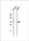 Forkhead Box E3 antibody, PA5-72448, Invitrogen Antibodies, Western Blot image 