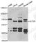 Glucagon-like peptide 2 receptor antibody, A6602, ABclonal Technology, Western Blot image 