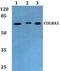 Collagen Type VIII Alpha 1 Chain antibody, A05638, Boster Biological Technology, Western Blot image 