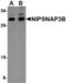 Nipsnap Homolog 3B antibody, TA306697, Origene, Western Blot image 
