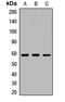 Lysophosphatidylcholine acyltransferase 1 antibody, orb412320, Biorbyt, Western Blot image 