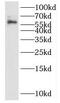 Interleukin 15 Receptor Subunit Alpha antibody, FNab04222, FineTest, Western Blot image 