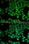 Transient Receptor Potential Cation Channel Subfamily M Member 2 antibody, LS-C346101, Lifespan Biosciences, Immunofluorescence image 