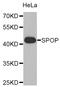 PCIF1 antibody, LS-C349276, Lifespan Biosciences, Western Blot image 
