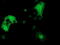 Dystrobrevin Alpha antibody, M05610, Boster Biological Technology, Immunofluorescence image 