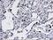 Malcavernin antibody, M01908-1, Boster Biological Technology, Immunohistochemistry paraffin image 