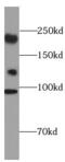 Coiled-coil and C2 domain-containing protein 2A antibody, FNab01337, FineTest, Western Blot image 