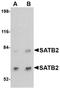 DNA-binding protein SATB2 antibody, NBP1-76913, Novus Biologicals, Western Blot image 