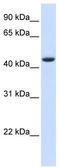 TRNA Aspartic Acid Methyltransferase 1 antibody, TA346721, Origene, Western Blot image 