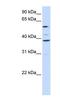 Graves disease carrier protein antibody, NBP1-59588, Novus Biologicals, Western Blot image 