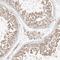 Mitochondrial Fission Regulator 2 antibody, HPA029792, Atlas Antibodies, Immunohistochemistry frozen image 