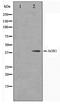 SUMO1 Activating Enzyme Subunit 1 antibody, TA347483, Origene, Western Blot image 