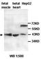 Sterol O-acyltransferase 1 antibody, orb77623, Biorbyt, Western Blot image 