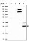 Cytochrome B561 Family Member D2 antibody, PA5-60137, Invitrogen Antibodies, Western Blot image 
