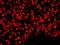 Nuclear Mitotic Apparatus Protein 1 antibody, NB100-74636, Novus Biologicals, Immunohistochemistry paraffin image 