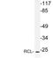 Deoxyribonucleoside 5 -monophosphate N-glycosidase antibody, LS-C177813, Lifespan Biosciences, Western Blot image 