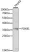 Forkhead box protein B1 antibody, LS-C750124, Lifespan Biosciences, Western Blot image 