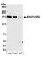 DNA repair protein complementing XP-G cells antibody, A301-484A, Bethyl Labs, Western Blot image 