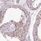 Chromosome 1 Open Reading Frame 56 antibody, NBP1-82174, Novus Biologicals, Immunohistochemistry frozen image 