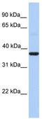 Zinc finger CCCH domain-containing protein 15 antibody, TA339734, Origene, Western Blot image 