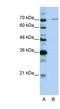 Pre-MRNA Processing Factor 3 antibody, NBP1-57201, Novus Biologicals, Western Blot image 