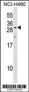 Myelin Protein Zero Like 2 antibody, 59-388, ProSci, Western Blot image 