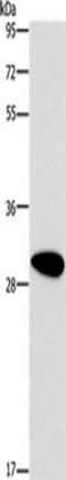 Dimethylarginine Dimethylaminohydrolase 2 antibody, TA351126, Origene, Western Blot image 