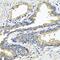 Electron Transfer Flavoprotein Subunit Alpha antibody, PA5-76240, Invitrogen Antibodies, Immunohistochemistry paraffin image 