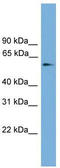 Forkhead Box C1 antibody, TA341795, Origene, Western Blot image 