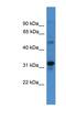 Transmembrane Protein 176B antibody, NBP1-80505, Novus Biologicals, Western Blot image 