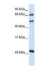 UNC Homeobox antibody, NBP1-91315, Novus Biologicals, Western Blot image 