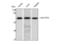 PTPN11 antibody, STJ95660, St John